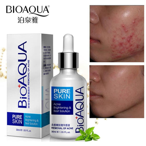 🤩LLEVA EN TU MISMO PEDIDO🎉🎁 SERUM ANTI-ACNE 🎁 ⭐GRAN DESCUENTO ❗🤩